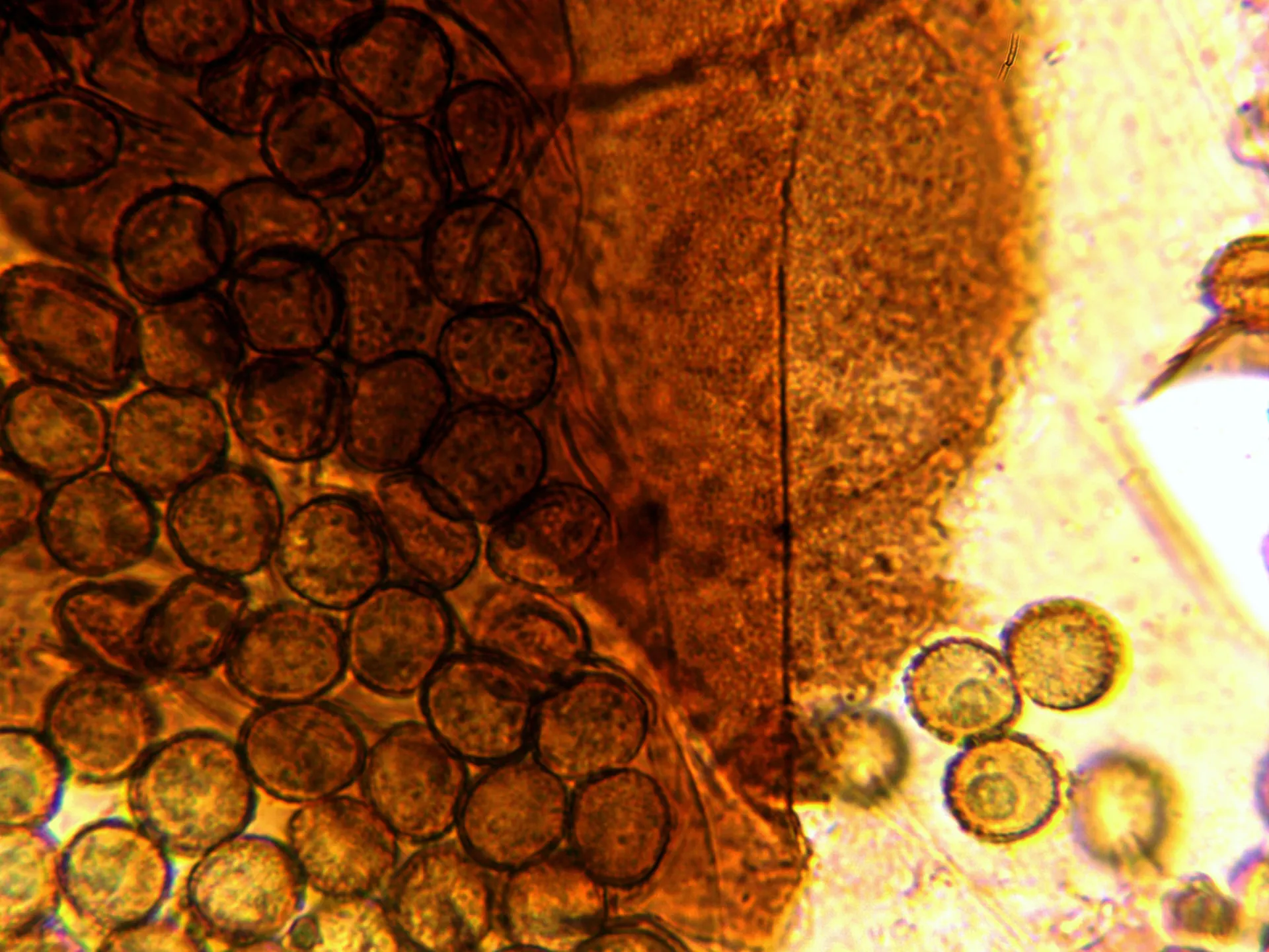 Microscopía de Metatrichia vesparia - 10 - Restos de peridio
